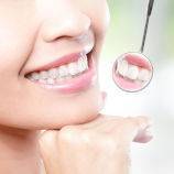 Healthy woman teeth and dentist mouth mirror